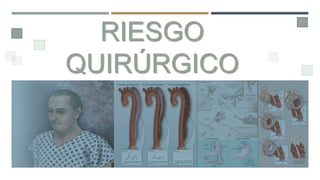 RIESGO
QUIRÚRGICO
 