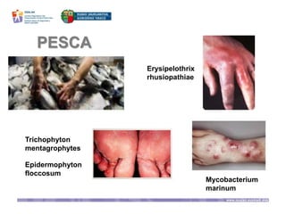 PESCA
Erysipelothrix
rhusiopathiae
Mycobacterium
marinum
Trichophyton
mentagrophytes
Epidermophyton
floccosum
 