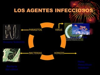 Virus del Sida Gusano Helminto Moho  Penicillium   notatum Bacteria del cólera HONGOS VIRUS PARASITOS BACTERIAS 