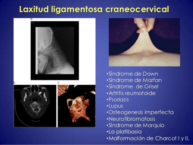La psoriasis sobre el pope al niño de la foto