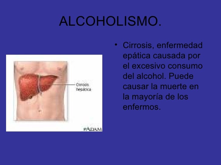 Como decidirse ir del marido del alcohólico con el niño
