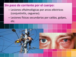 – Lesiones oftalmológicas por arcos eléctricos
(conjuntivitis, cegueras).
– Lesiones físicas secundarias por caídas, golpes,
etc.
 