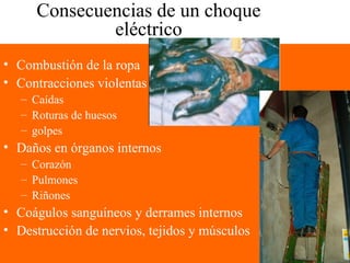 Consecuencias de un choque
eléctrico
• Combustión de la ropa
• Contracciones violentas
– Caídas
– Roturas de huesos
– golpes
• Daños en órganos internos
– Corazón
– Pulmones
– Riñones
• Coágulos sanguíneos y derrames internos
• Destrucción de nervios, tejidos y músculos
 
