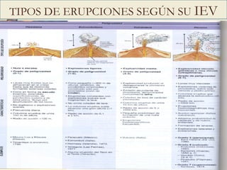 TIPOS DE ERUPCIONES SEGÚN SU  IEV 