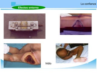 La confianza
Efectos entorno
Iridio
 