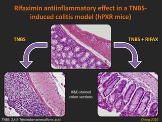 Rifaximin antiinflammatory effect in a TNBS-
induced colitis model (hPXR mice)
TNBS: 2,4,6-Trinitrobenzenesulfonic acid
TNBS TNBS + RIFAX
H&E-stained
colon sections
Cheng 2010
 