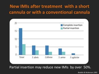 New IMIs after treatment with a short
cannula or with a conventional cannula
Complete insertion
Partial insertion
Partial insertion may reduce new IMIs by over 50%.
Boddie & Nickerson 1991
 