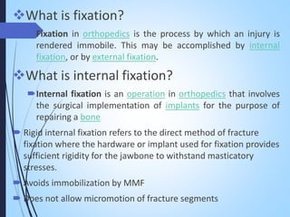 Semi Rigid Fixation Examples Rigid internal fixation in oral surgery | PPTX