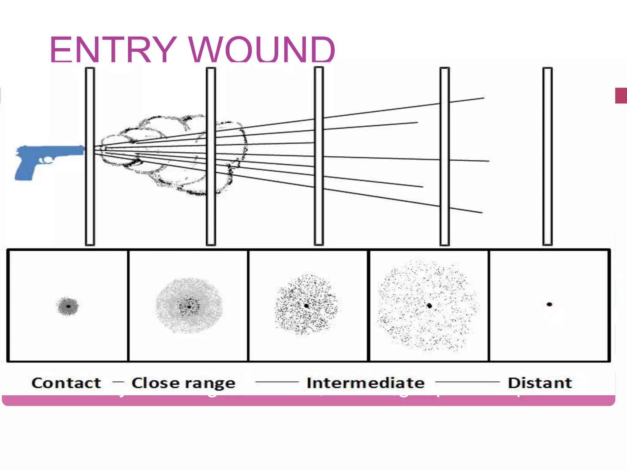 Rifled weapon injuries | PPT
