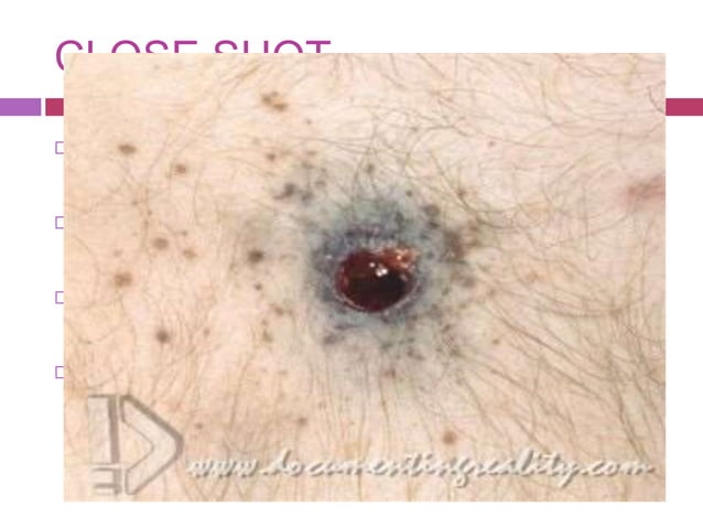 Rifled weapon injuries | PPTX | Arms & Ammunition | Sensitive Topics