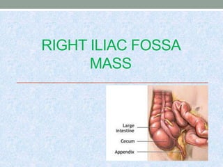 RIGHT ILIAC FOSSA
MASS
 