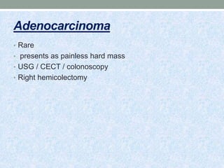 Adenocarcinoma
• Rare
• presents as painless hard mass
• USG / CECT / colonoscopy
• Right hemicolectomy
 
