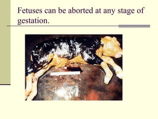 Fetuses can be aborted at any stage of
gestation.
 