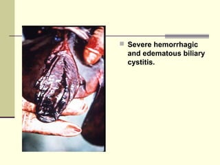 Severe hemorrhagic
  and edematous biliary
  cystitis.
 