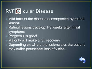  Mild

form of the disease accompanied by retinal
lesions.
 Retinal lesions develop 1-3 weeks after initial
symptoms
 Prognosis is good
 Majority will make a full recovery
 Depending on where the lesions are, the patient
may suffer permanent loss of vision.

 
