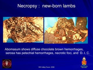 Necropsy :  new-born lambs Abomasum shows diffuse chocolate brown hemorrhages, serosa has petechial hemorrhages, necrotic foci, and  D. I. C. 