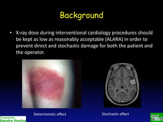 Background
• X-ray dose during interventional cardiology procedures should
be kept as low as reasonably acceptable (ALARA) in order to
prevent direct and stochastic damage for both the patient and
the operator.

Deterministic effect

Stochastic effect

 