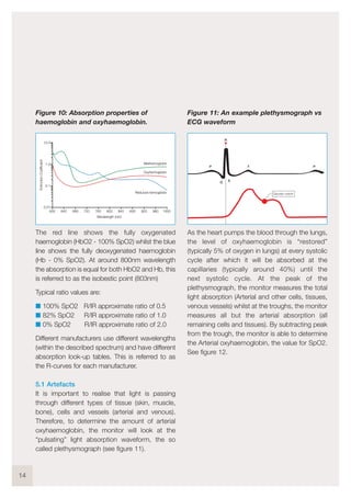 Figure 10: Absorption properties of
haemoglobin and oxyhaemoglobin.
The red line shows the fully oxygenated
haemoglobin (HbO2 - 100% SpO2) whilst the blue
line shows the fully deoxygenated haemoglobin
(Hb - 0% SpO2). At around 800nm wavelength
the absorption is equal for both HbO2 and Hb, this
is referred to as the isobestic point (803nm)
Typical ratio values are:
I 100% SpO2 R/IR approximate ratio of 0.5
I 82% SpO2 R/IR approximate ratio of 1.0
I 0% SpO2 R/IR approximate ratio of 2.0
Different manufacturers use different wavelengths
(within the described spectrum) and have different
absorption look-up tables. This is referred to as
the R-curves for each manufacturer.
5.1 Artefacts
It is important to realise that light is passing
through different types of tissue (skin, muscle,
bone), cells and vessels (arterial and venous).
Therefore, to determine the amount of arterial
oxyhaemoglobin, the monitor will look at the
“pulsating” light absorption waveform, the so
called plethysmograph (see figure 11).
Figure 11: An example plethysmograph vs
ECG waveform
As the heart pumps the blood through the lungs,
the level of oxyhaemoglobin is “restored”
(typically 5% of oxygen in lungs) at every systolic
cycle after which it will be absorbed at the
capillaries (typically around 40%) until the
next systolic cycle. At the peak of the
plethysmograph, the monitor measures the total
light absorption (Arterial and other cells, tissues,
venous vessels) whilst at the troughs, the monitor
measures all but the arterial absorption (all
remaining cells and tissues). By subtracting peak
from the trough, the monitor is able to determine
the Arterial oxyhaemoglobin, the value for SpO2.
See figure 12.
14
Dicrotic notch
Q S
P T P
R
10.0
1.0
0.1
0.01
600 640 680 720 760 800 840 600 920
Methemoglobin
Oxyhemoglobin
Reduced hemoglobin
Wavelength (nm)
ExtinctionCoefficient
960 1000
 