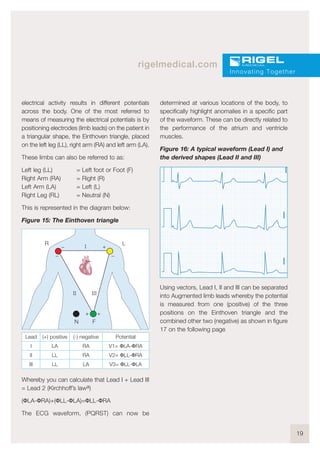 19
rigelmedical.com
electrical activity results in different potentials
across the body. One of the most referred to
means of measuring the electrical potentials is by
positioning electrodes (limb leads) on the patient in
a triangular shape, the Einthoven triangle, placed
on the left leg (LL), right arm (RA) and left arm (LA).
These limbs can also be referred to as:
Left leg (LL) = Left foot or Foot (F)
Right Arm (RA) = Right (R)
Left Arm (LA) = Left (L)
Right Leg (RL) = Neutral (N)
This is represented in the diagram below:
Figure 15: The Einthoven triangle
Whereby you can calculate that Lead I + Lead III
= Lead 2 (Kirchhoff’s lawa)
(ΦLA-ΦRA)+(ΦLL-ΦLA)=ΦLL-ΦRA
The ECG waveform, (PQRST) can now be
determined at various locations of the body, to
specifically highlight anomalies in a specific part
of the waveform. These can be directly related to
the performance of the atrium and ventricle
muscles.
Figure 16: A typical waveform (Lead I) and
the derived shapes (Lead II and III)
Using vectors, Lead I, II and III can be separated
into Augmented limb leads whereby the potential
is measured from one (positive) of the three
positions on the Einthoven triangle and the
combined other two (negative) as shown in figure
17 on the following page
Innovating Together
R L
N F
_ +
++
_ _
l
l
Potential
V1= ΦLA-ΦRA
V2= ΦLL-ΦRA
V3= ΦLL-ΦLA
(-) negative
RA
RA
LA
(+) positive
LA
LL
LL
Lead
I
II
III
 