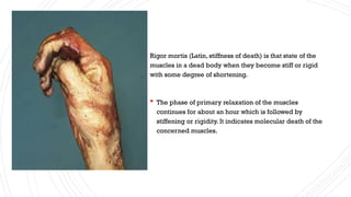 riger Mortis presentation of forensic science | PPTX