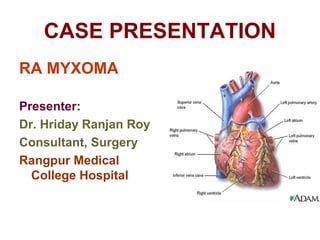 CASE PRESENTATION
RA MYXOMA
Presenter:
Dr. Hriday Ranjan Roy
Consultant, Surgery
Rangpur Medical
College Hospital

 