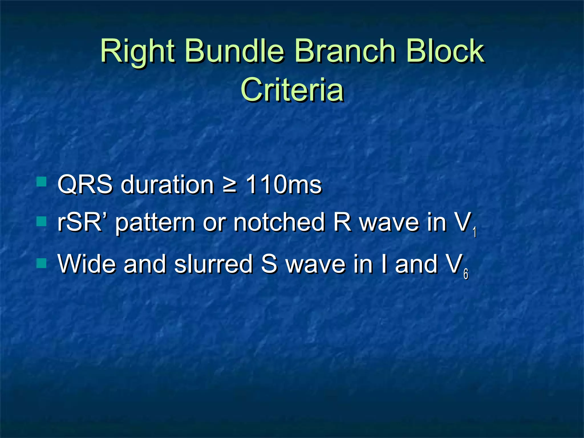 Right Bundle Branch Block
Criteria




QRS duration ≥ 110ms
rSR’ pattern or notched R wave in V 1
Wide and slurred S wave in I and V 6

 