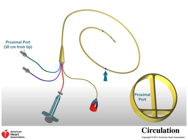 RIGHT HEART CATHETERISTION 1.ppt | Heart and Cardiovascular Diseases ...