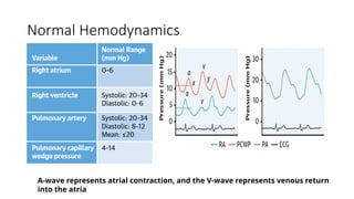 Rhc Waveforms RIGHT HEART CATHETERIZATION (RHC) STUDY.pptx