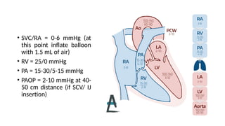 Rhc Waveforms RIGHT HEART CATHETERIZATION (RHC) STUDY.pptx