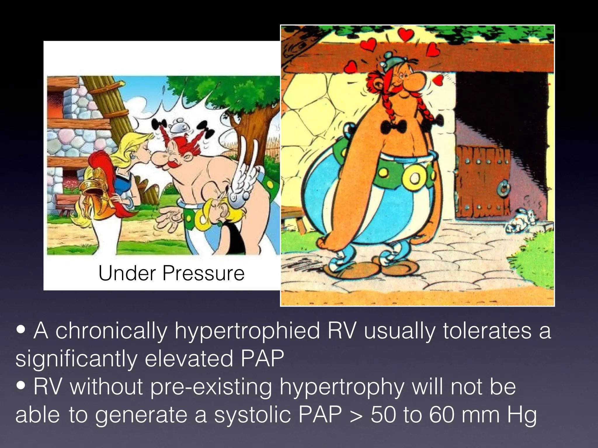Under Pressure

• A chronically hypertrophied RV usually tolerates a
significantly elevated PAP
• RV without pre-existing hypertrophy will not be
able to generate a systolic PAP > 50 to 60 mm Hg
 