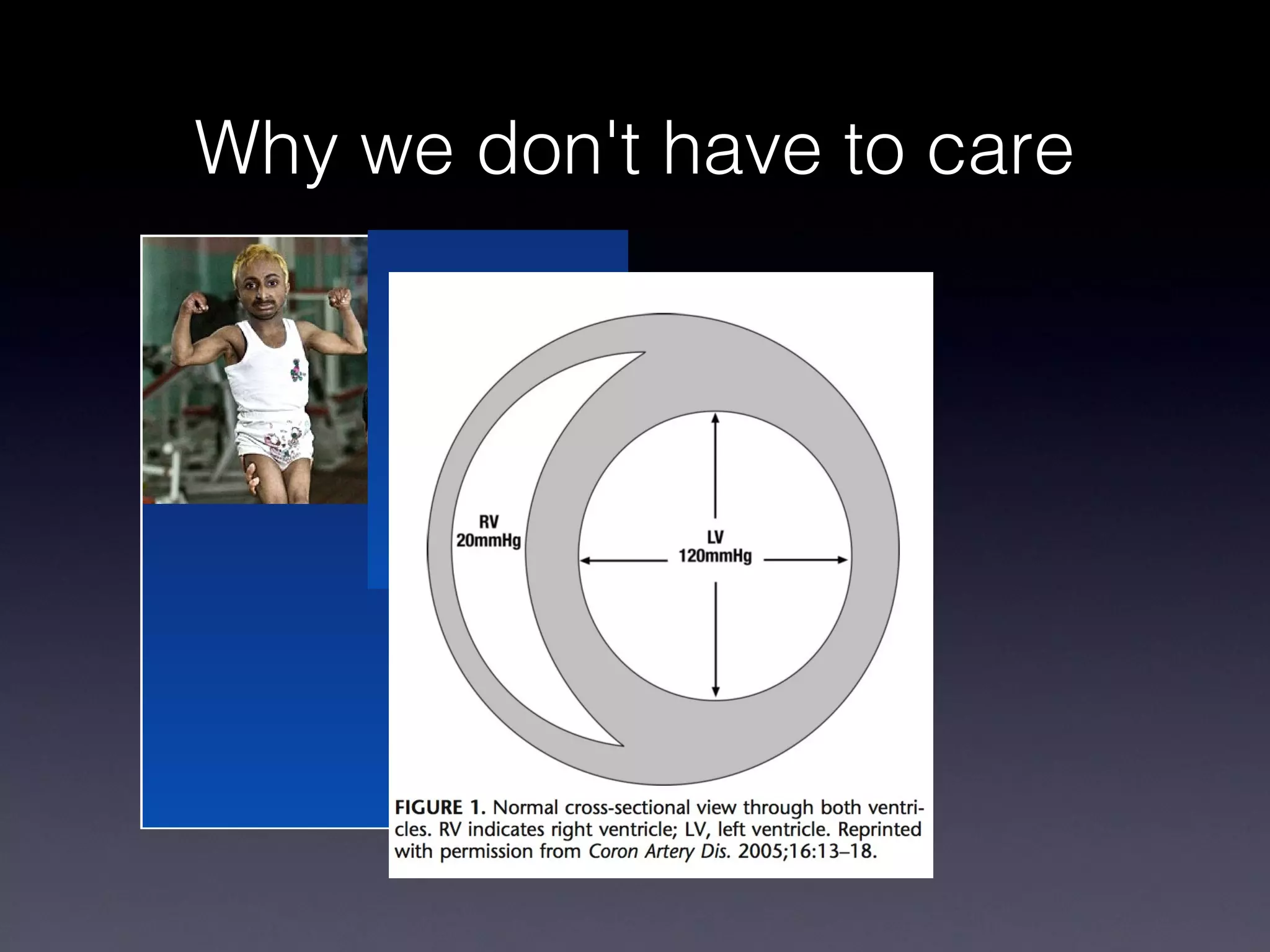 Why we don't have to care
 