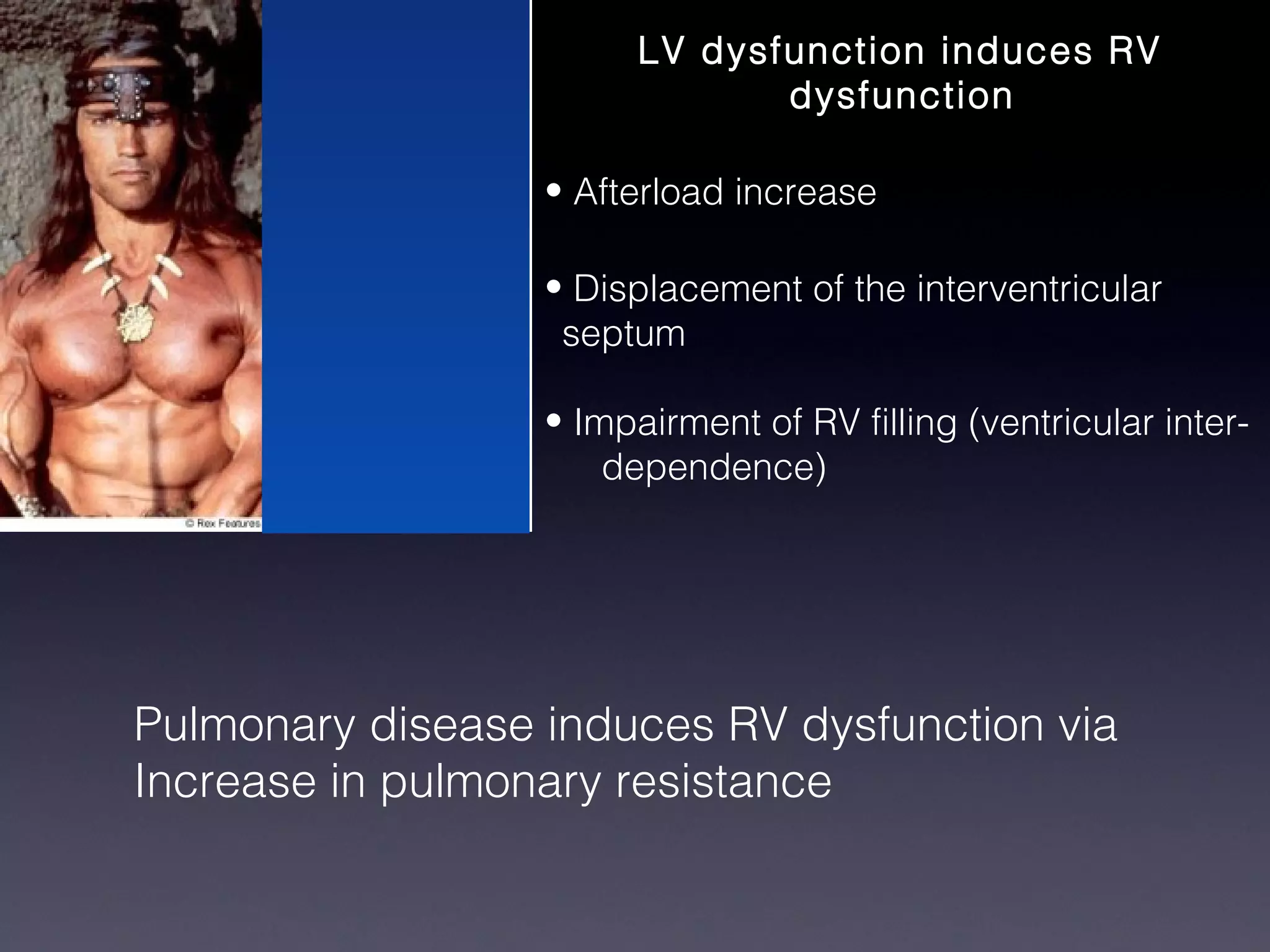 LV dysfunction induces RV
                               dysfunction

                  • Afterload increase

                  • Displacement of the interventricular
                   septum

                  • Impairment of RV filling (ventricular inter-
                      dependence)




Pulmonary disease induces RV dysfunction via
Increase in pulmonary resistance
 