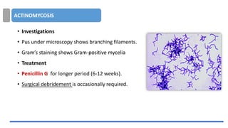 ACTINOMYCOSIS
• Investigations
• Pus under microscopy shows branching filaments.
• Gram’s staining shows Gram-positive mycelia
• Treatment
• Penicillin G for longer period (6-12 weeks).
• Surgical debridement is occasionally required.
 
