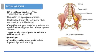 PSOAS ABSCESS
• It’s a cold abscess due to TB of
Thoracolumbar spine T10 .
• It can also be a pyogenic abscess.
• It is localized, smooth, soft, nonmobile
mass in the right iliac fossa.
• Caseating pus from vertebra gravitates via
medial arcuate ligament underneath psoas
sheath.
• Spinal tenderness + spinal movements
will be restricted.
• psoas sign
• Cross fluctuation – pus tracks below
inguinal ligament into thigh
 