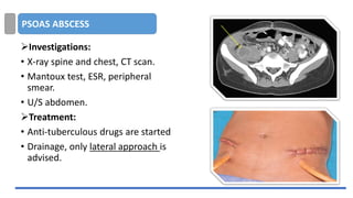 PSOAS ABSCESS
➢Investigations:
• X-ray spine and chest, CT scan.
• Mantoux test, ESR, peripheral
smear.
• U/S abdomen.
➢Treatment:
• Anti-tuberculous drugs are started
• Drainage, only lateral approach is
advised.
 