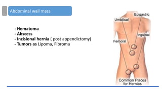 Abdominal wall mass
- Hematoma
- Abscess
- Incisional hernia ( post appendictomy)
- Tumors as Lipoma, Fibroma
 