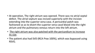 • At operation, The right atrium was opened. There was no atrial septal
defect. The atrial septum was incised superiorly with the incision
extending into the superior vena cava. A pericardial patch was
fashioned so as to divert the superior vena caval blood into the right
atrium and the pulmonary venous return into the left atrium.
• The right atrium was also patched with the pericardium to increase
its size.
• The patient also had SVD (RCA Prox 100%), which was bypassed using
RSVG.
 