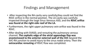 Findings and Management
• After inspecting the RA cavity very carefully,they could not find the
RSVC orifice in the normal position. The LA cavity was carefully
inspected through the large Sinus Venosus ASD, and the RSVC orifice
was found at the right-side roof of the LA.
• Furthermore, the right upper pulmonary vein orifice was found in the
RSVC.
• After dealing with SVASD, and rerouting the pulmonary venous
channel, The cephalic edge of the atrial appendage flap was
anastomosed to the anterior external wall of the SVC beyond the
SVC-RA junction to avoid injury to the sinus nodal artery. Then the
extracardiac rerouting of RSVC flow was completed.
 