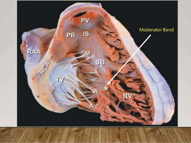 Right Ventricle Anatomy, Physiology & ECHO Assessment by Dr. Vaibhav…
