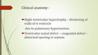 Clinical anatomy-
Right ventricular hypertrophy – thickening of
walls of rt ventricle
due to pulmonary hypertension
Ventricular septal defect – congenital defect –
abnormal opening in septum
 