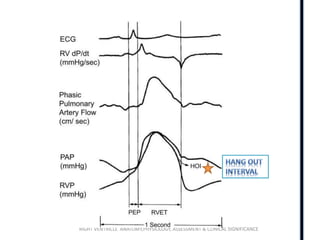 Ventricular Rhy Right ventricle anatomy ,physiology and echo findings.ppt
