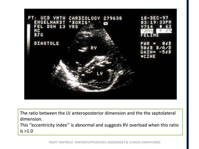 Right ventricle anatomy ,physiology and echo findings.ppt | Heart and ...