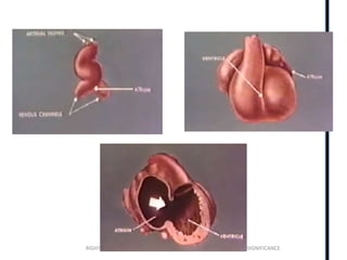Ventricular Rhy Right ventricle anatomy ,physiology and echo findings.ppt