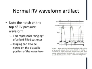 Right ventricle anatomy ,physiology and echo findings.ppt