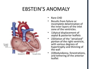 EBSTEIN’S ANOMALY
• Rare CHD
• Results from failure or
incomplete delamination of
the inner layers of the inlet
zone of the ventricles.
• 1)Apical displacement of
septal & posterior leaflets
• 2)Dilation of the “atrialized”
portion of the right ventricle,
with various degrees of
hypertrophy and thinning of
the wall
• (3)Redundancy, fenestrations,
and tethering of the anterior
leaflet
 