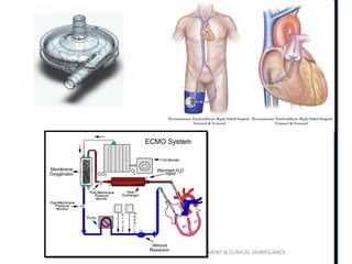 RIGHT VENTRICLE ANATOMY,PHYSIOLOGY, ASSESSMENT & CLINICAL SIGNIFICANCE
CENTRIMAG
 