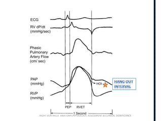 RIGHT VENTRICLE ANATOMY,PHYSIOLOGY, ASSESSMENT & CLINICAL SIGNIFICANCE
 