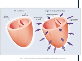 RIGHT VENTRICLE ANATOMY,PHYSIOLOGY, ASSESSMENT & CLINICAL SIGNIFICANCE
 