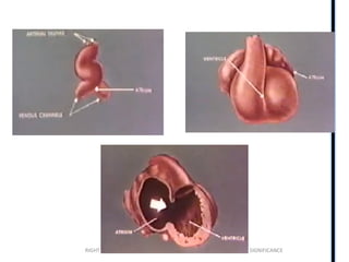 RIGHT VENTRICLE ANATOMY,PHYSIOLOGY, ASSESSMENT & CLINICAL SIGNIFICANCE
 