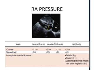 RIGHT VENTRICLE ANATOMY,PHYSIOLOGY, ASSESSMENT & CLINICAL SIGNIFICANCE
RA PRESSURE
 